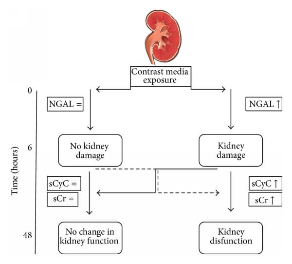 胱抑素C（CysC）與NGAL、肌酐的關(guān)系
