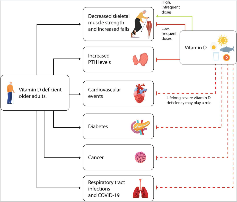 老年人缺乏維生素D對骨骼的額外影響以及維生素D的預(yù)防作用
